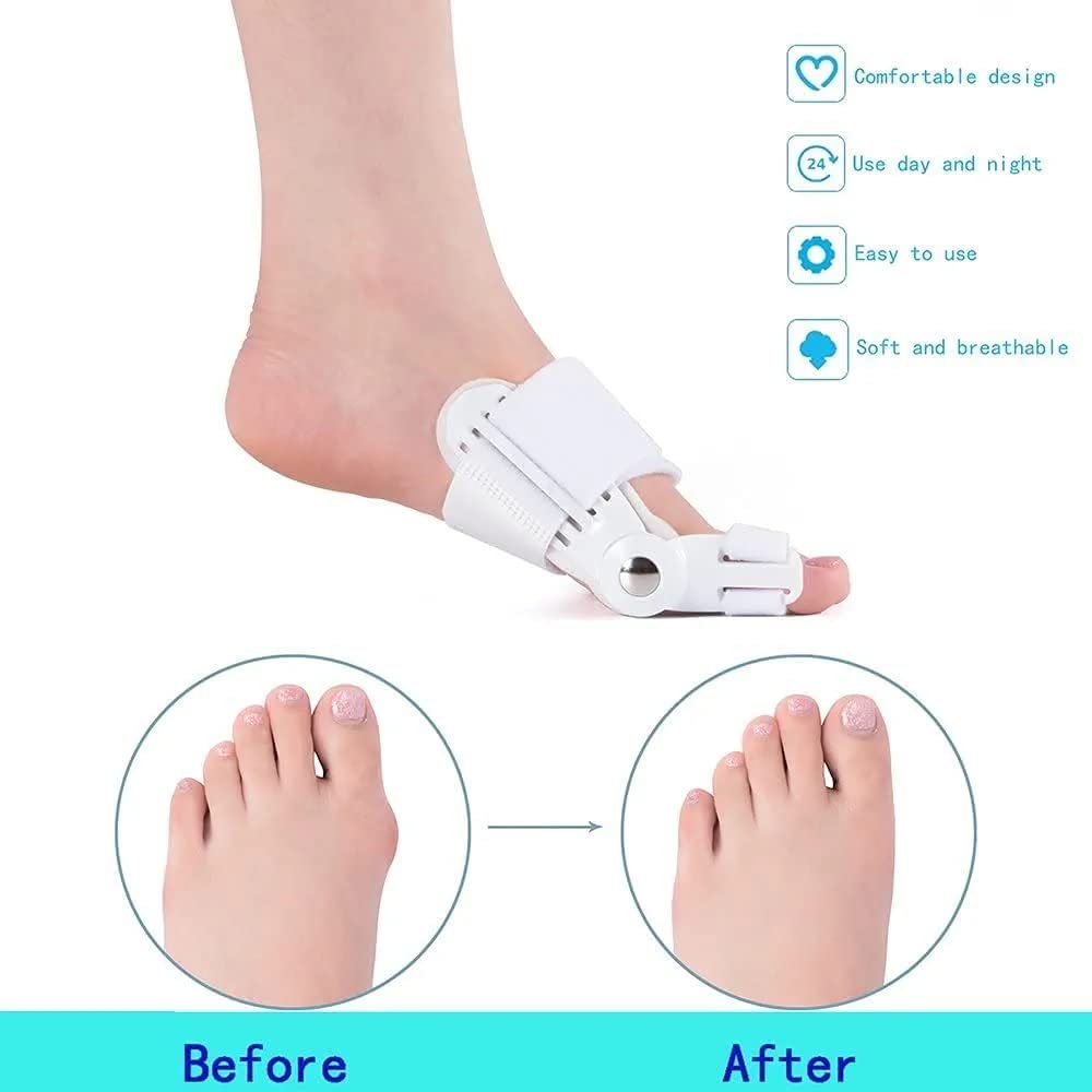 1 Pcs Toe Straightener