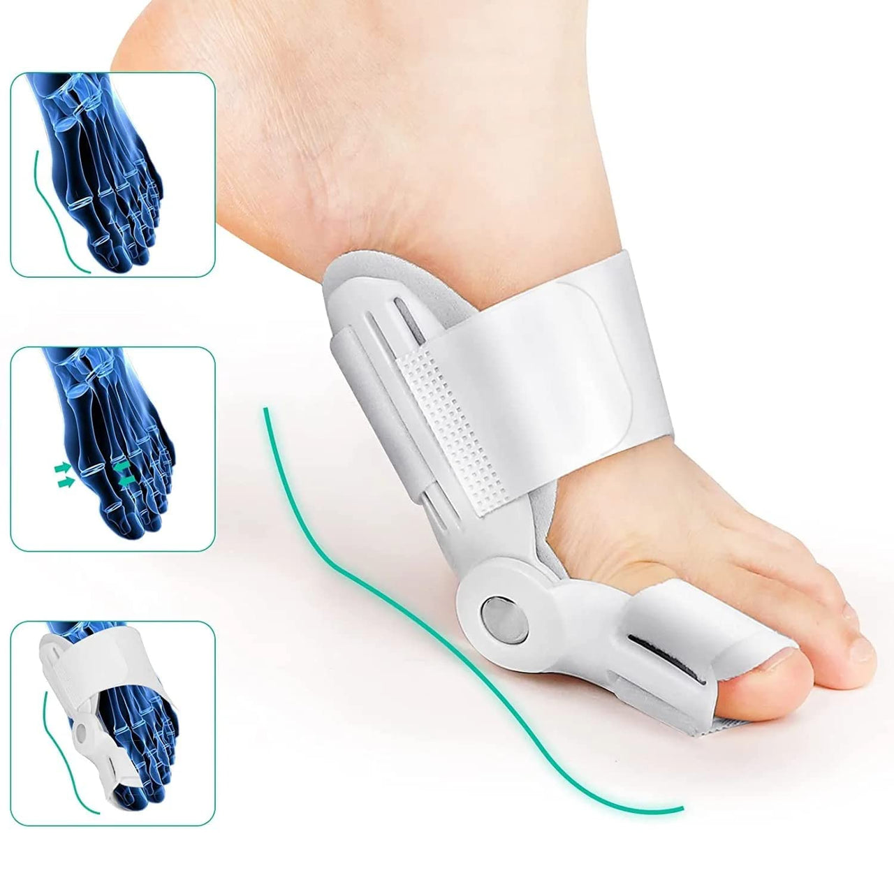 1 Pcs Toe Straightener