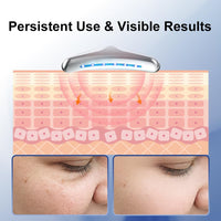 Thumbnail for Skin Care Red Light Therapy for Face Facial Massager