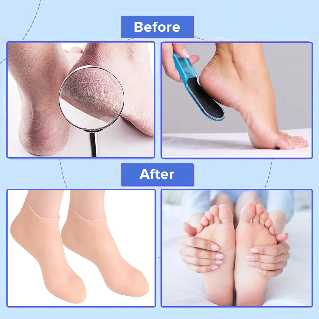 Moisturizing Foot Socks